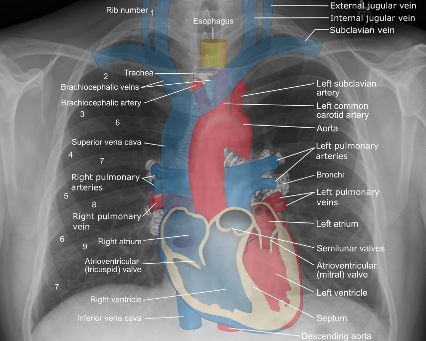 CT Scans
